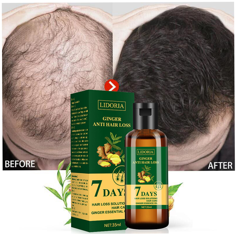 Ingrown Hair Serum - Ginger Hair Growth Essential Oil Natural