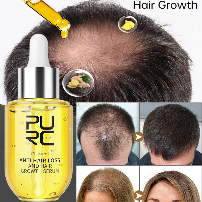 PURC Hair Growth Serum for Men - Ingrown Hair Serum avis et prix