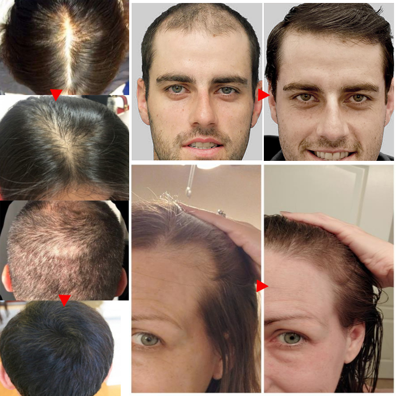 Ginger Hair Growth Essential O - Ingrown Hair Serum avis et prix