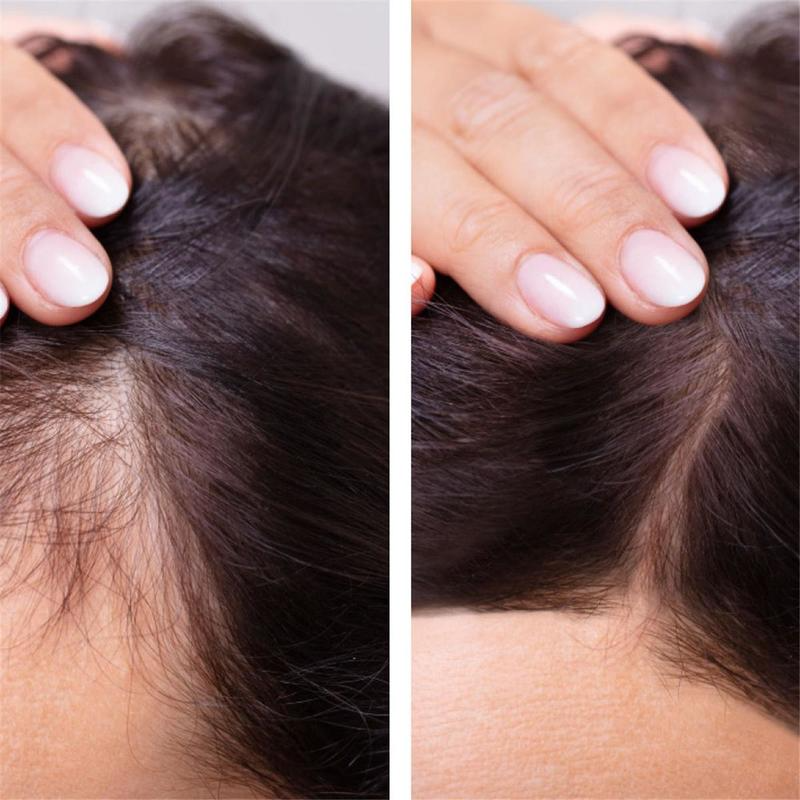 Ginger Hair Growth Essential O - Ingrown Hair Serum avis et prix
