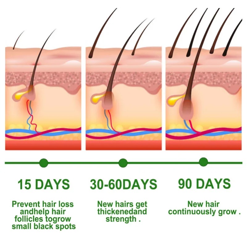 Hair Growth Serum Fast Growing - Ingrown Hair Serum avis et prix