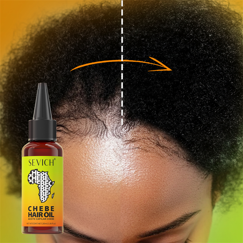 Chebe Fast Hair Growth Oil Afr - Ingrown Hair Serum avis et prix