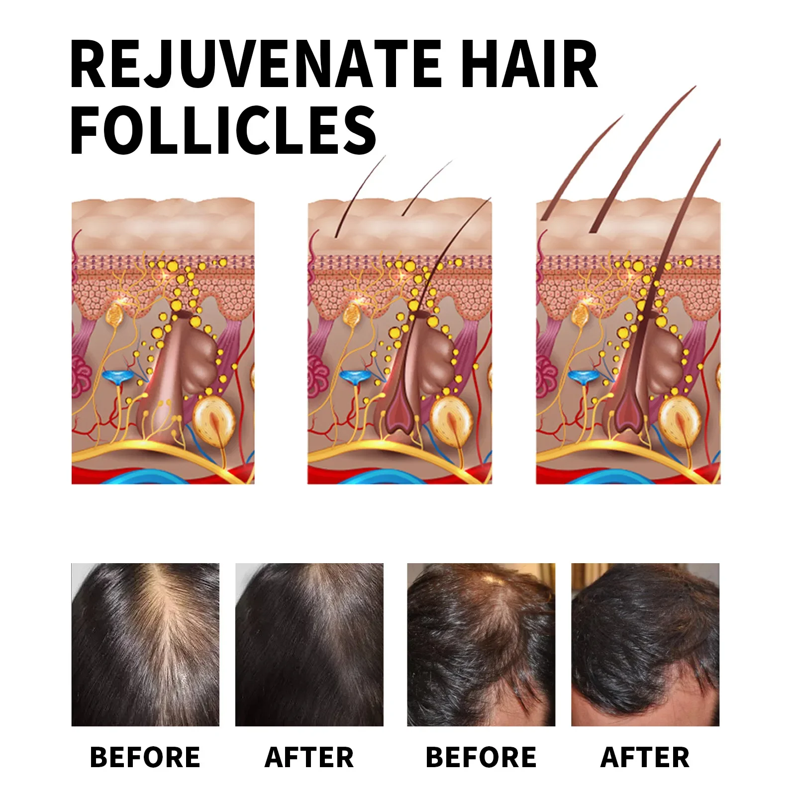 Ginger Hair Growth Products Fa - Ingrown Hair Serum avis et prix