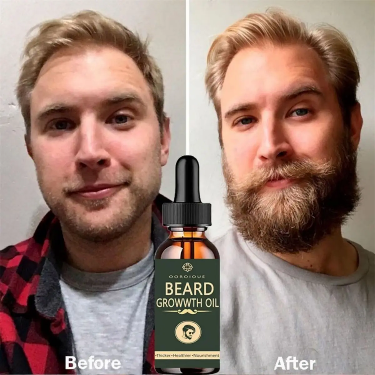 Fast Beard Growth Oil Beard Oi - Ingrown Hair Serum avis et prix
