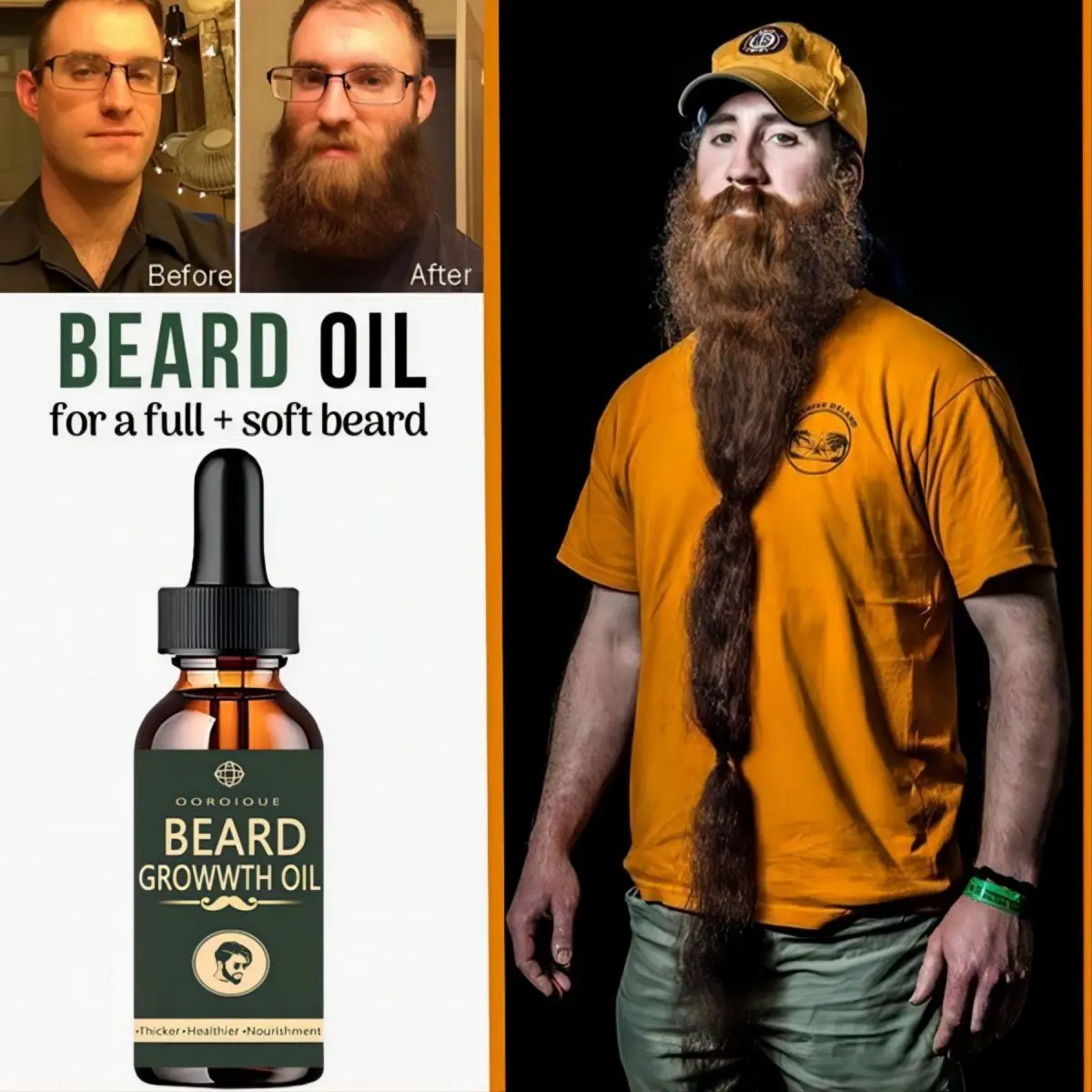 Fast Beard Growth Oil Beard Oi - Ingrown Hair Serum avis et prix