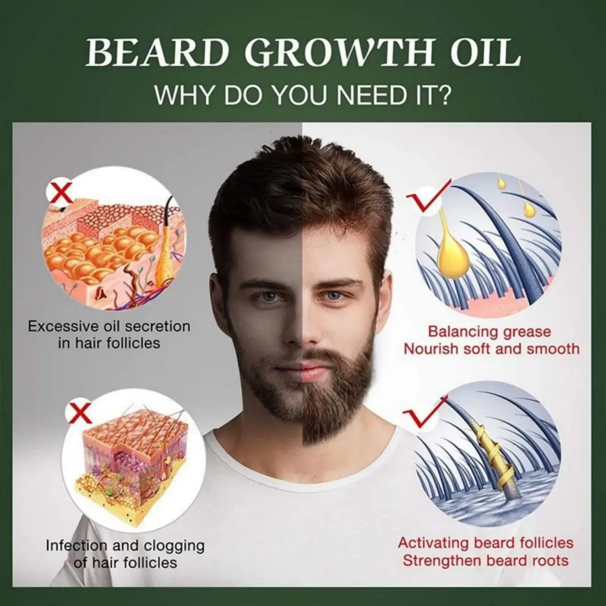 Fast Beard Growth Oil Beard Oi - Ingrown Hair Serum avis et prix