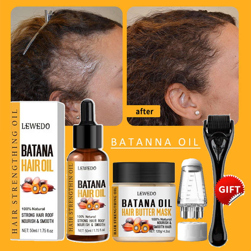 Batana Oil Hair Growth Kit Tra - Ingrown Hair Serum avis et prix