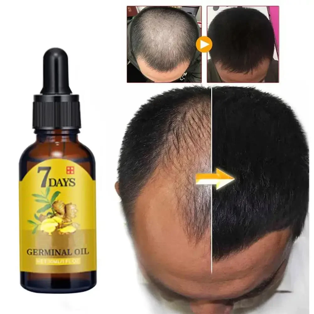 Hair Growth Ginger Fast Growin - Ingrown Hair Serum avis et prix