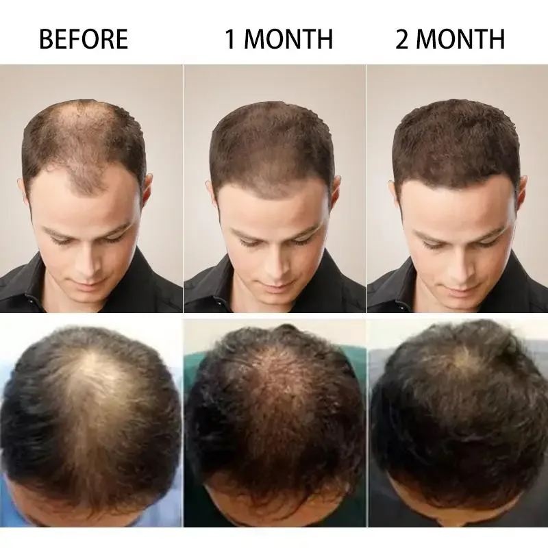 Hair Growth Ginger Fast Growin - Ingrown Hair Serum avis et prix