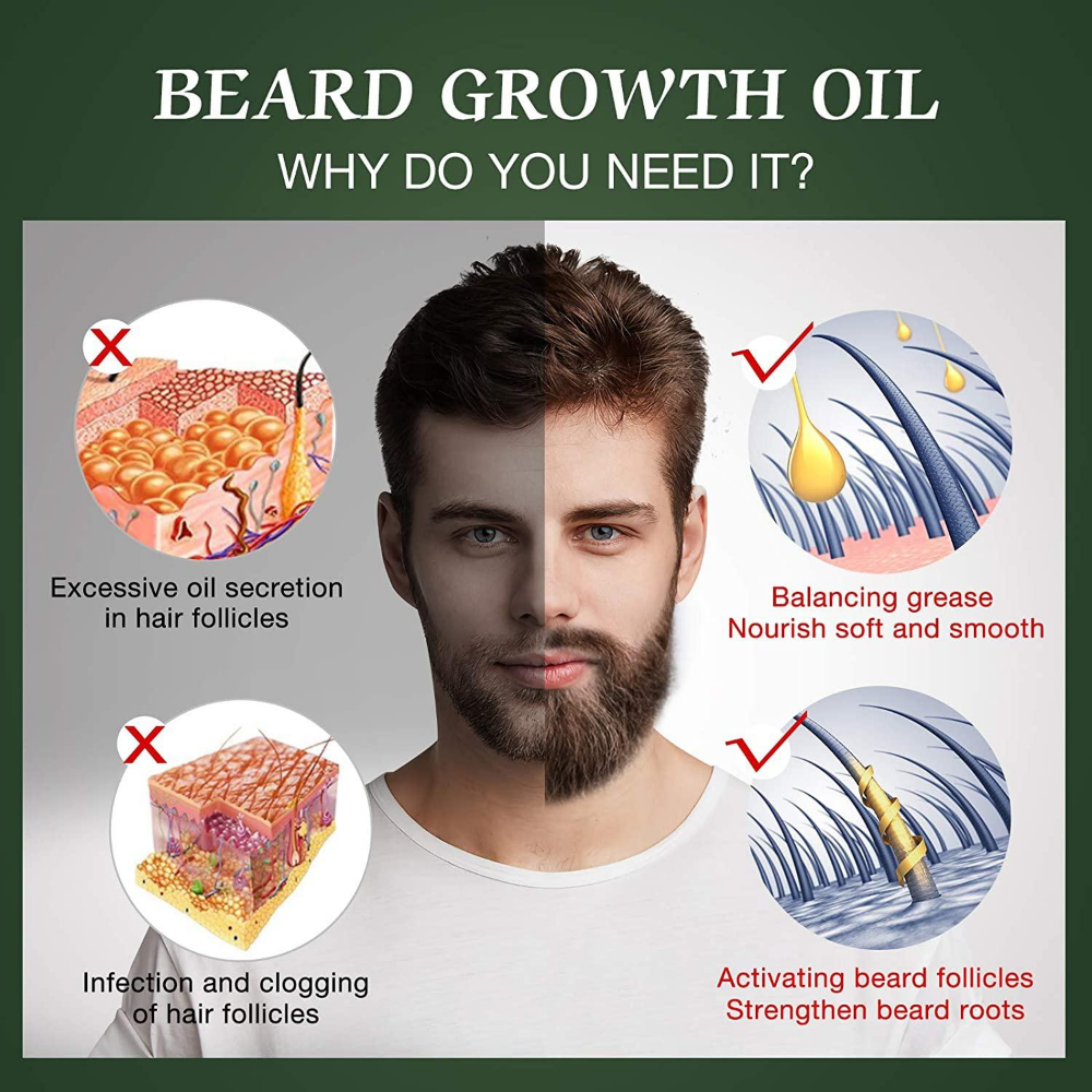 Fast Beard Growth Oil Beard Oi - Ingrown Hair Serum avis et prix