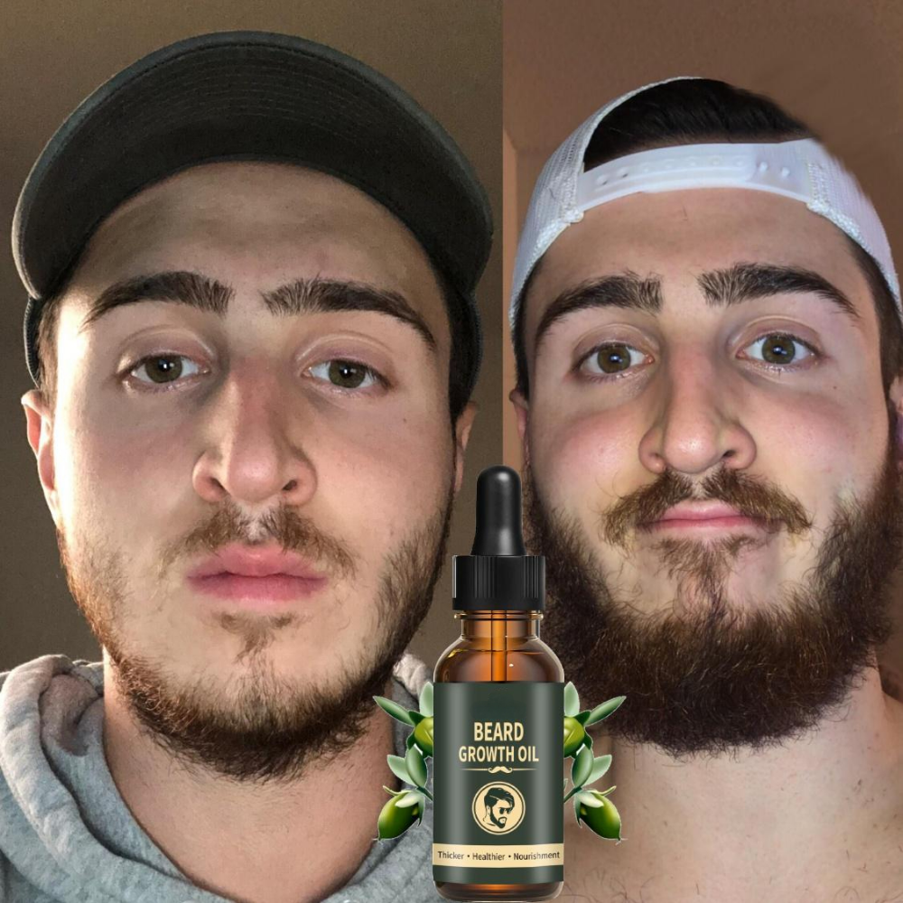 Fast Beard Growth Oil Beard Oi - Ingrown Hair Serum avis et prix