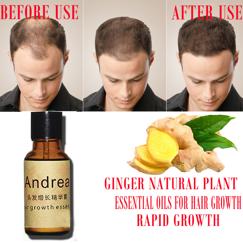 2/5/10Pcs Andrea Hair Growth S - Ingrown Hair Serum avis et prix