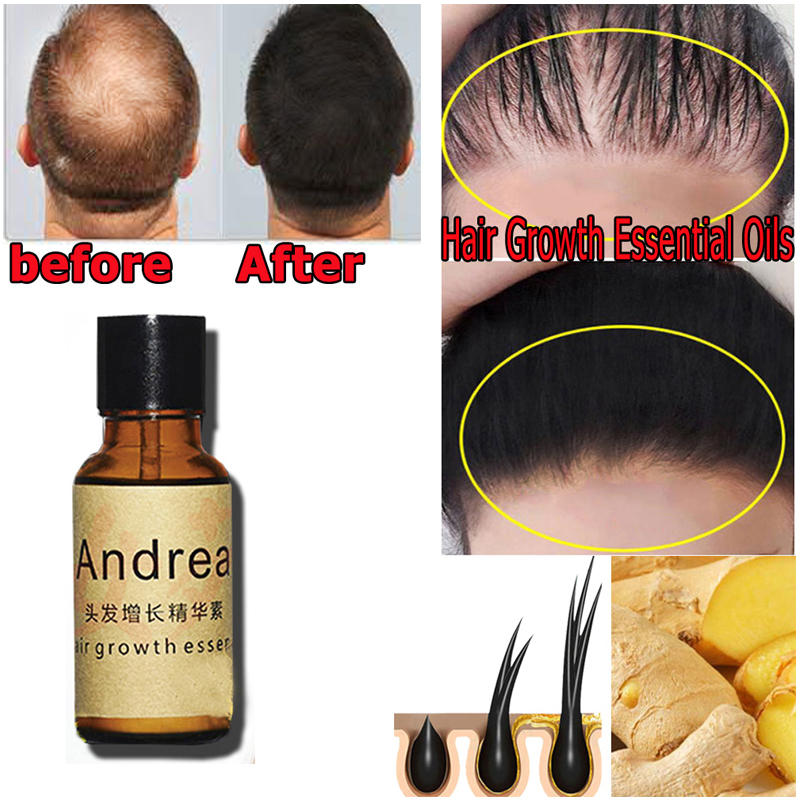2/5/10Pcs Andrea Hair Growth S - Ingrown Hair Serum avis et prix
